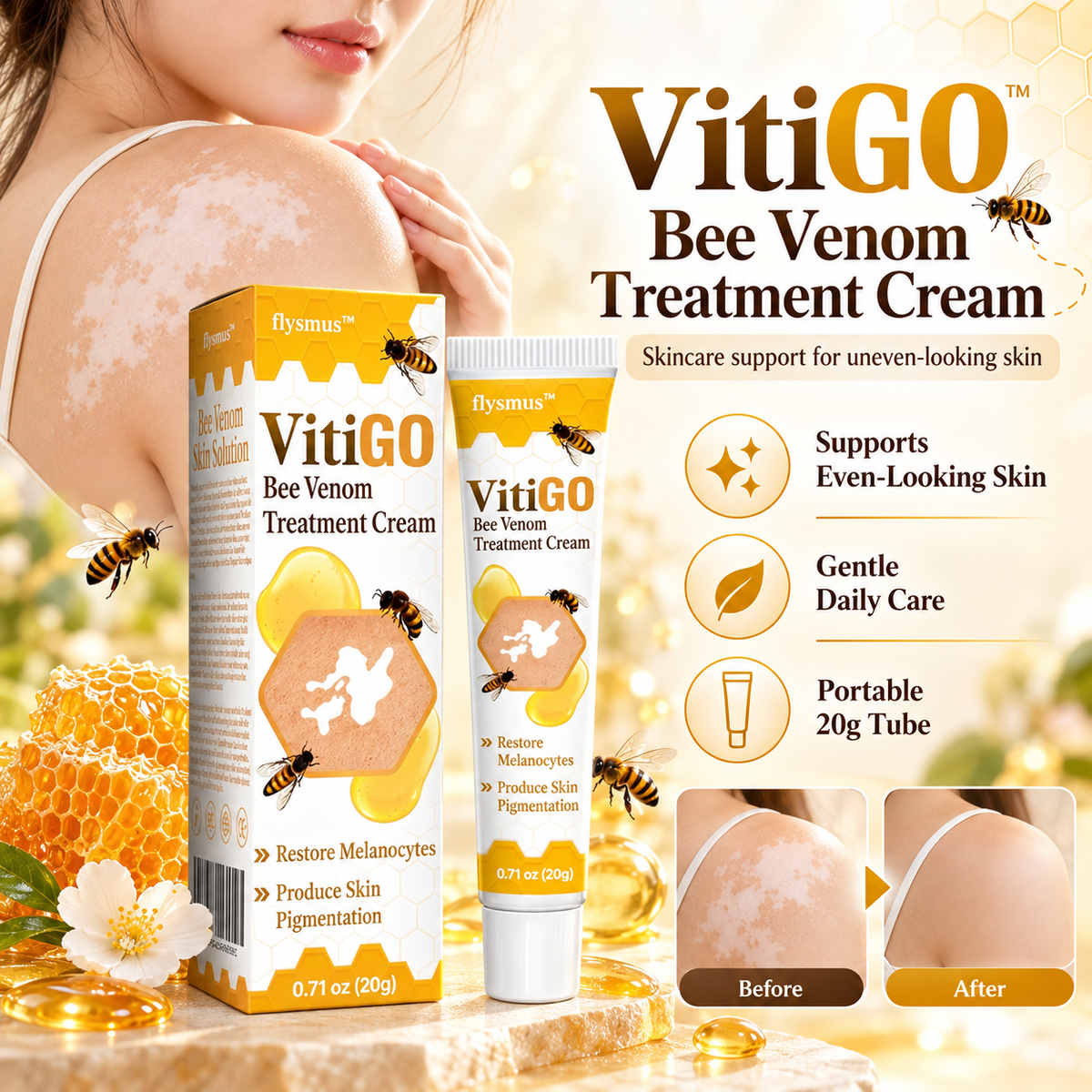 Vitiligo Treatment Cream | Bee Venom Vitiligo Treatment Ointment