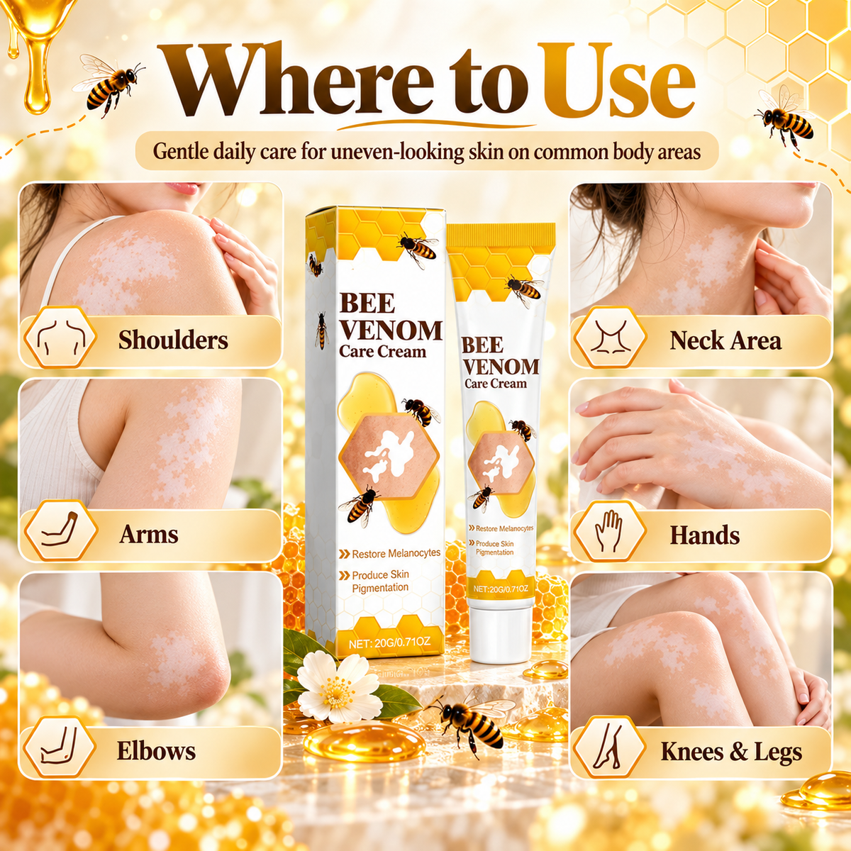 Vitiligo Treatment Cream | Bee Venom Vitiligo Treatment Ointment