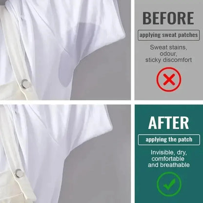 Disposable Underarm Sweat Pads - Invisible, Breathable, Anti-Odor & Comfortable - diverse depot official