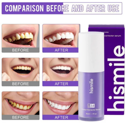 Korean Instant Teeth Whitening Paste | Buy 1 Get 1 FREE